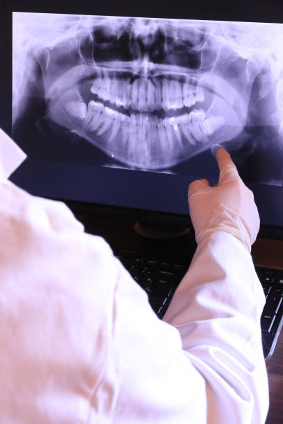 Best Emergency Root Canal Treatment in Daniel, UT